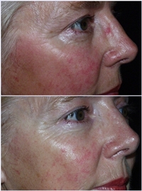 Software: Microsoft Office